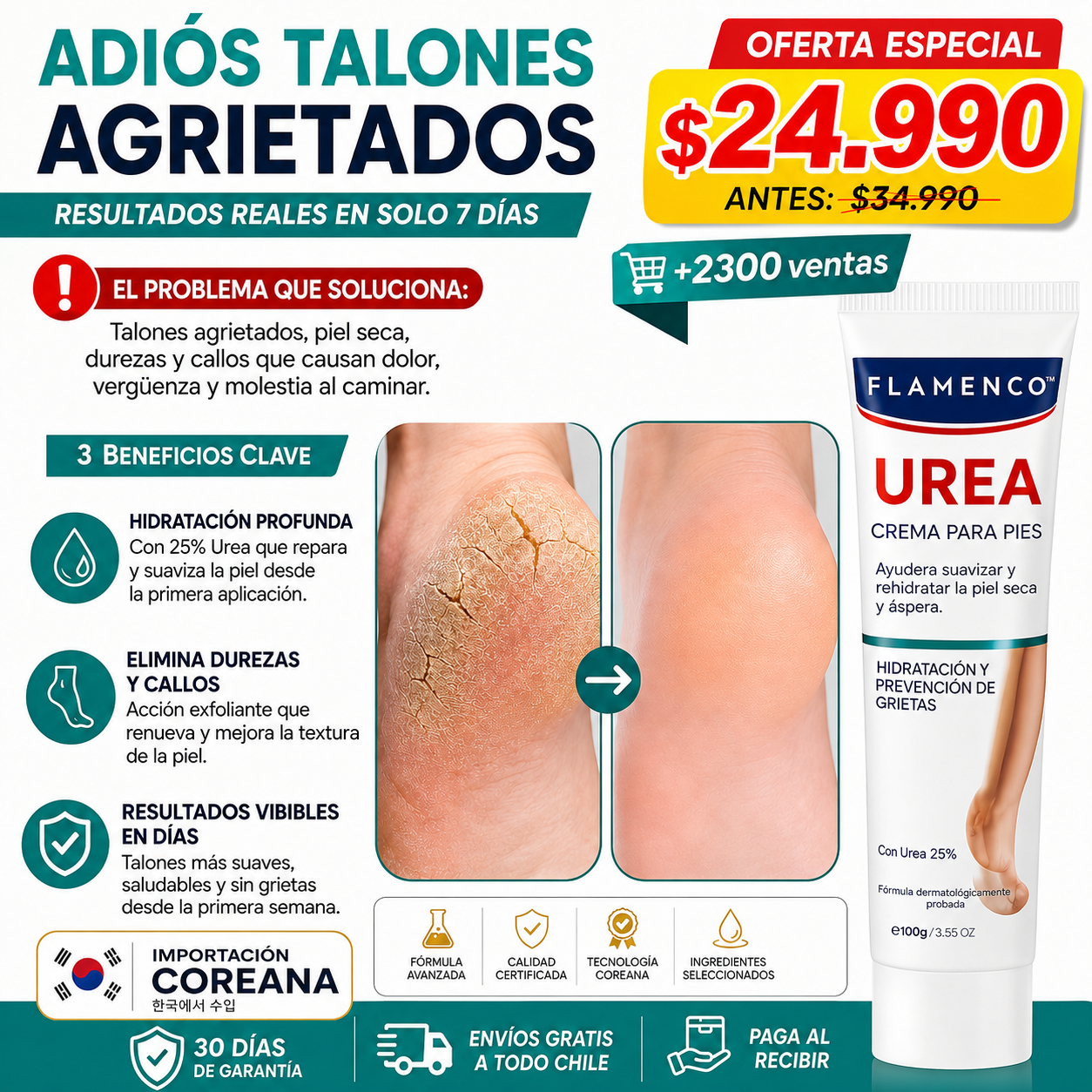 CREMA DE UREA RECOMENDADA POR DERMATOLOS-Adiós Talones Y manos Agrietados