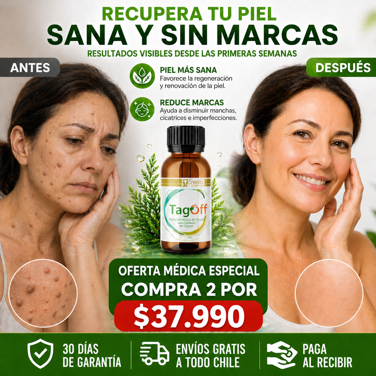 OFERTA ESPECIAL TAG OFF-La Solución para Verrugas y Carnosidades